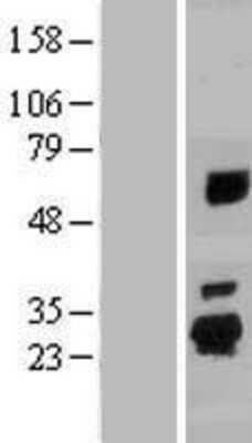 Western Blot: SPATA24 Overexpression Lysate [NBP2-10072]