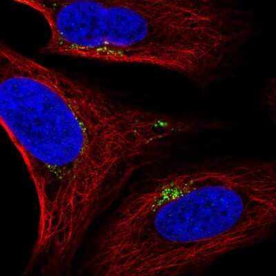 Immunocytochemistry/ Immunofluorescence: SPATA25 Antibody [NBP2-58954]