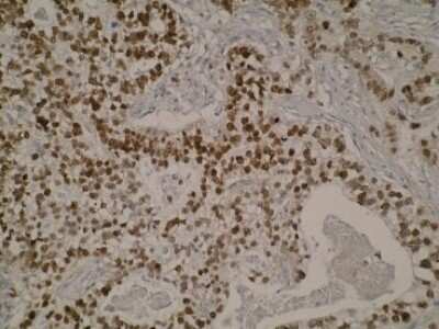Immunohistochemistry: SPATA25 Antibody (Z37P3H11*B2) - BSA Free [NBP2-50305]