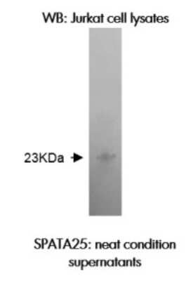 Western Blot: SPATA25 Antibody (Z37P3H11*B2)BSA Free [NBP2-50305]