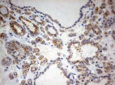 Immunohistochemistry: SPATA2L Antibody (OTI3F6) [NBP2-45940]
