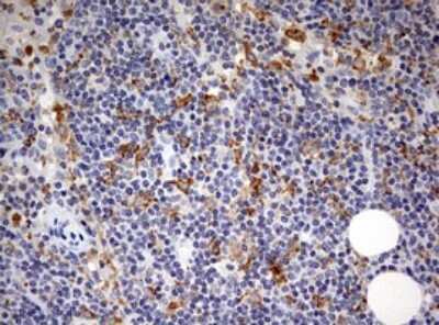 Immunohistochemistry: SPATA2L Antibody (OTI3F6) [NBP2-45940]