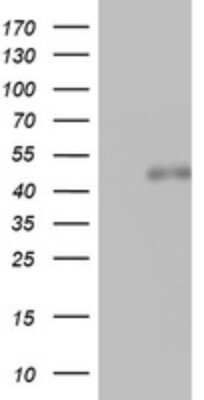 Western Blot: SPATA2L Antibody (OTI3F6) [NBP2-45940]