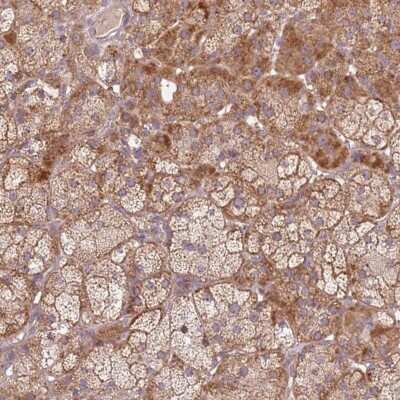 Immunohistochemistry-Paraffin: SPATA2L Antibody [NBP2-48765]