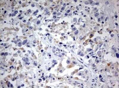 Immunohistochemistry: SPATA2L Antibody (OTI3F6) - Azide and BSA Free [NBP2-74310]