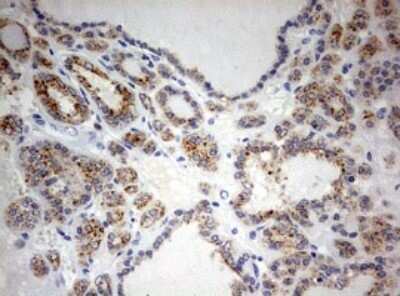 Immunohistochemistry: SPATA2L Antibody (OTI3F6) - Azide and BSA Free [NBP2-74310]