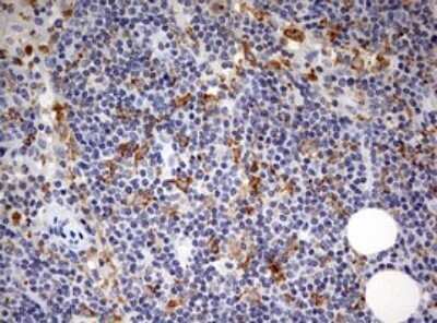 Immunohistochemistry: SPATA2L Antibody (OTI3F6) - Azide and BSA Free [NBP2-74310]