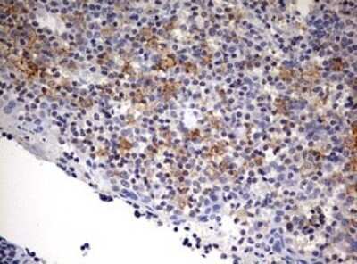 Immunohistochemistry: SPATA2L Antibody (OTI3F6) - Azide and BSA Free [NBP2-74310]