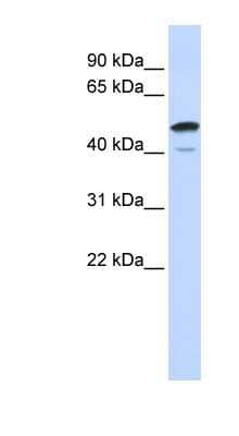 Western Blot: SPATA2L Antibody [NBP1-56681]