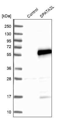 Western Blot: SPATA2L Antibody [NBP2-47265]