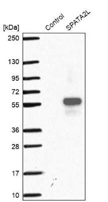 Western Blot: SPATA2L Antibody [NBP2-48765]