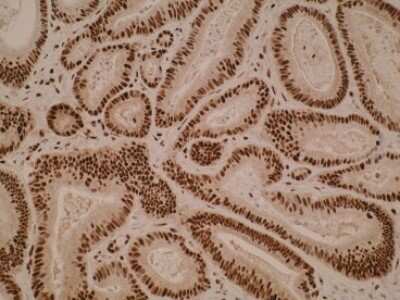 Immunohistochemistry: SPATA2L Antibody (Z2P2D5*C8) - BSA Free [NBP2-50306]