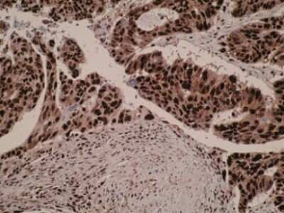Immunohistochemistry-Paraffin: SPATA2L Antibody (Z2P2D5*C8) - BSA Free [NBP2-50306]