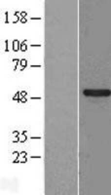 Western Blot: SPATA2L Overexpression Lysate [NBL1-16381]