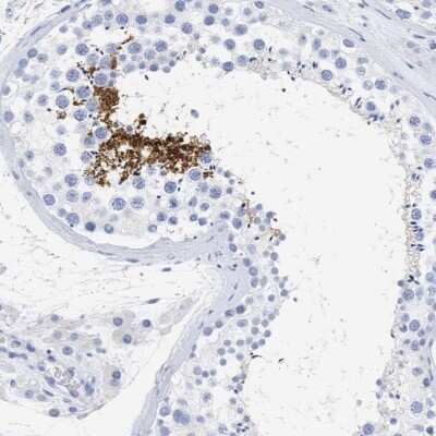 Immunohistochemistry-Paraffin: SPATA3 Antibody [NBP1-80661]