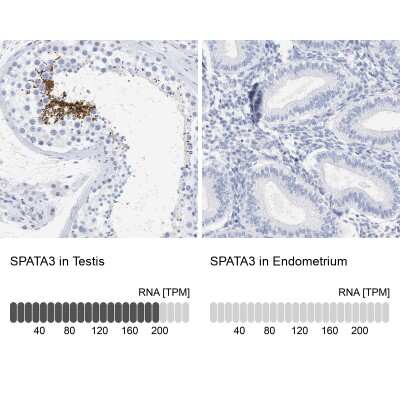 Immunohistochemistry-Paraffin: SPATA3 Antibody [NBP1-80661]