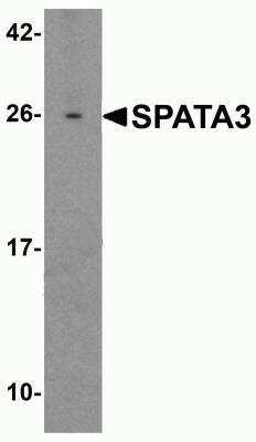 Western Blot: SPATA3 AntibodyBSA Free [NBP2-81816]