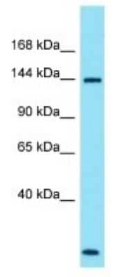 Western Blot: SPATA31A1 Antibody [NBP3-09710]