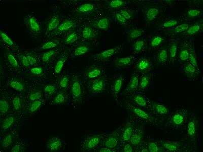 Immunocytochemistry/ Immunofluorescence: SPATA31E1 Antibody [NBP3-06105]