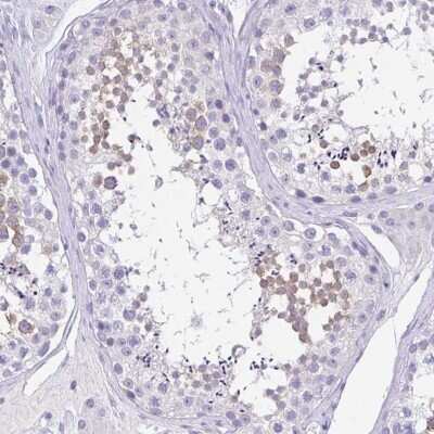 Immunohistochemistry-Paraffin: SPATA4 Antibody [NBP1-80731]