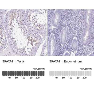 Immunohistochemistry-Paraffin: SPATA4 Antibody [NBP1-80731]