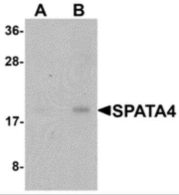 Western Blot: SPATA4 AntibodyBSA Free [NBP2-81852]