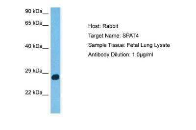 Western Blot: SPATA4 Antibody [NBP2-88344]