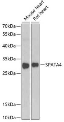 Western Blot: SPATA4 AntibodyBSA Free [NBP2-93377]