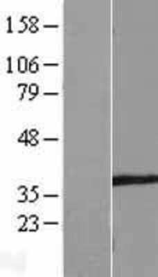 Western Blot: SPATA4 Overexpression Lysate [NBL1-16382]