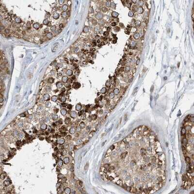 Immunohistochemistry-Paraffin: SPATA5 Antibody [NBP2-38302]