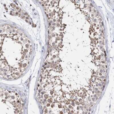 Immunohistochemistry-Paraffin: SPATA5 Antibody [NBP1-89214]