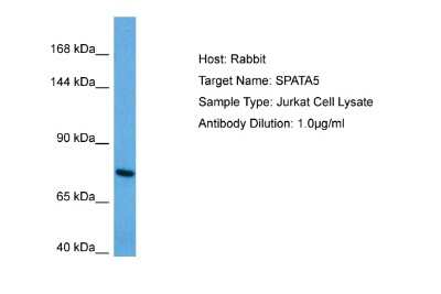 Western Blot: SPATA5 Antibody [NBP2-88345]