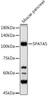 Western Blot: SPATA5 AntibodyAzide and BSA Free [NBP3-16028]