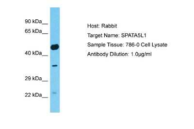 Western Blot: SPATA5L1 Antibody [NBP2-85804]