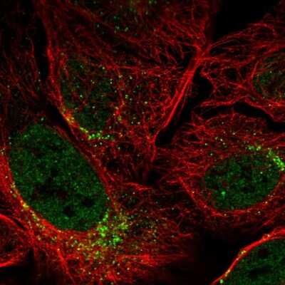 Immunocytochemistry/ Immunofluorescence: SPATA6 Antibody [NBP2-58812]