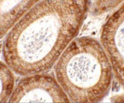 Immunohistochemistry: SPATA6 Antibody - BSA Free [NBP2-81853]