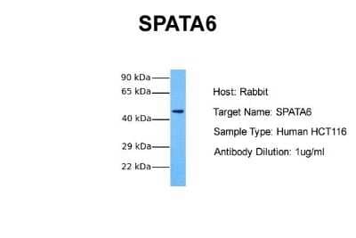 Western Blot: SPATA6 Antibody [NBP1-70710]