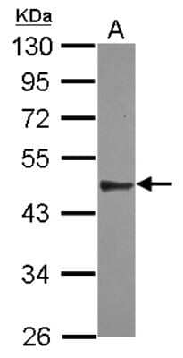 Western Blot: SPATA6 Antibody [NBP2-20468]