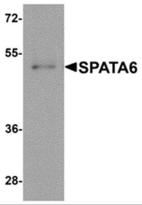 Western Blot: SPATA6 AntibodyBSA Free [NBP2-81853]