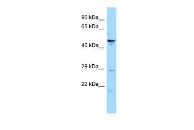 Western Blot: SPATA6 Antibody [NBP2-88346]