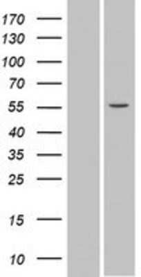 Western Blot: SPATA6 Overexpression Lysate [NBP2-06729]