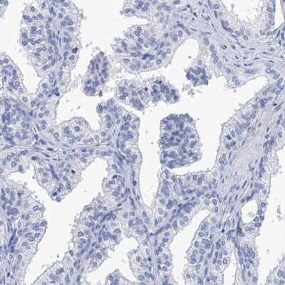 Immunohistochemistry-Paraffin: SPATA7 Antibody [NBP1-83195]