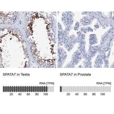 Immunohistochemistry-Paraffin: SPATA7 Antibody [NBP1-83195]