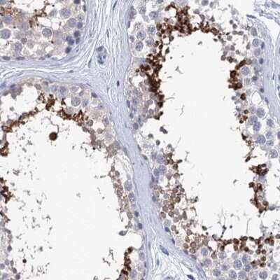 Immunohistochemistry-Paraffin: SPATA7 Antibody [NBP1-83195]