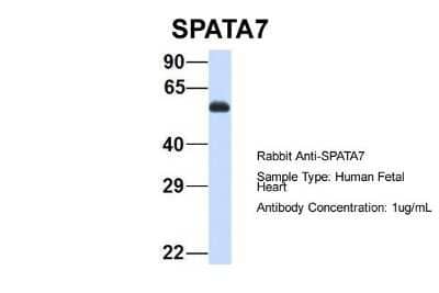 Western Blot: SPATA7 Antibody [NBP1-56884]