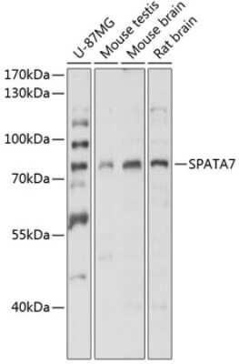 Western Blot: SPATA7 AntibodyBSA Free [NBP2-93192]