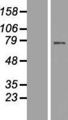 Western Blot: SPATA7 Overexpression Lysate [NBP2-06801]