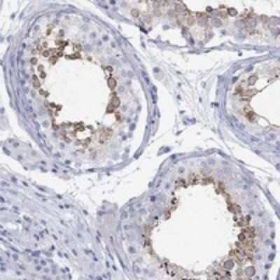 Immunohistochemistry-Paraffin: SPATA9 Antibody [NBP3-17313]