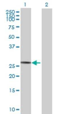 Western Blot: SPATA9 Antibody [H00083890-B01P]