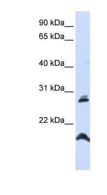 Western Blot: SPATA9 Antibody [NBP1-59460]